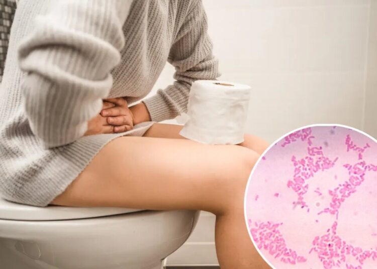 Having trouble pooping despite trying everything? You might have ‘bacterial constipation’