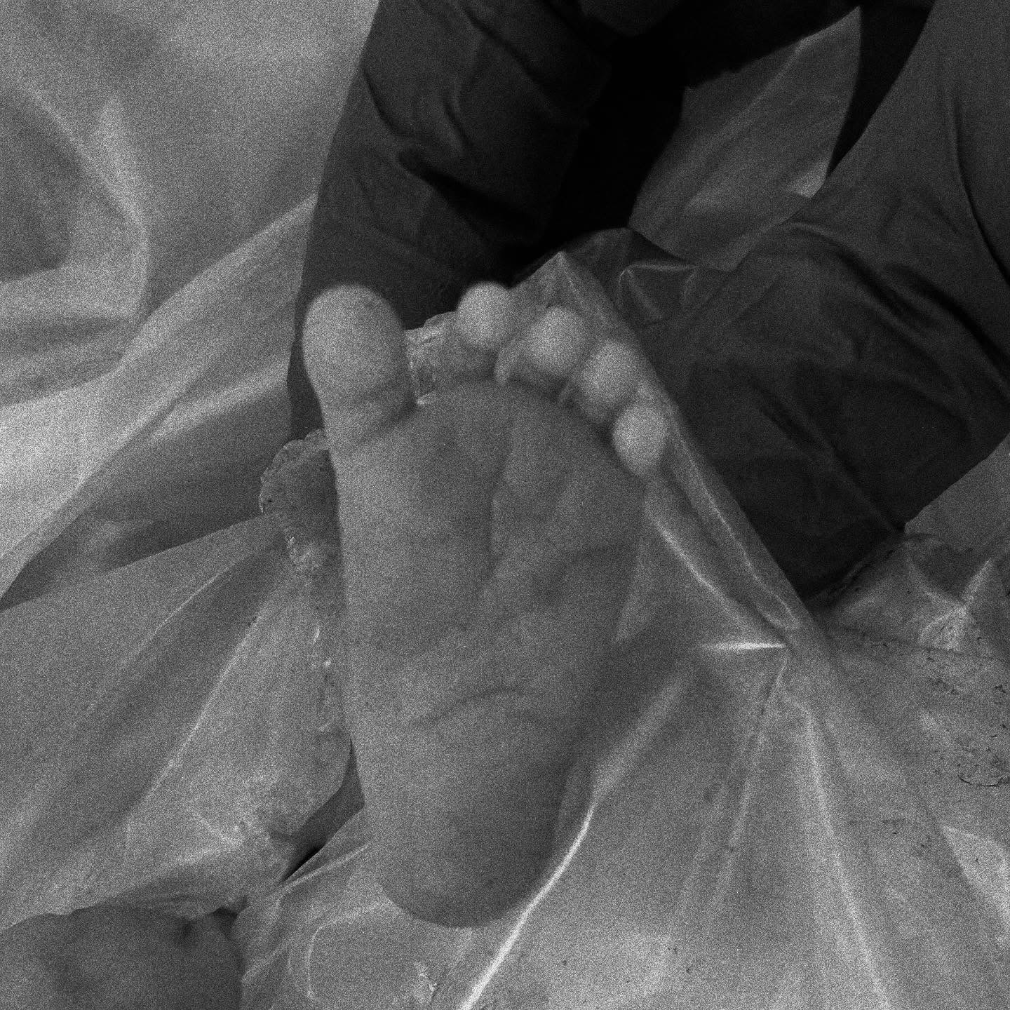 Black and white photo of a baby's tiny foot, with an adult's gloved hand gently holding it, on a crinkled translucent surface.