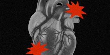 The New Way to Predict Your Risk of a Heart Attack