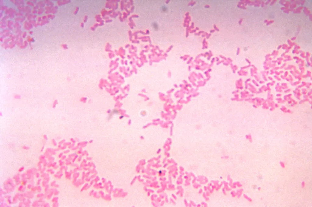 Photomicrograph of pink Bacteroides thetaiotaomicron bacteria.