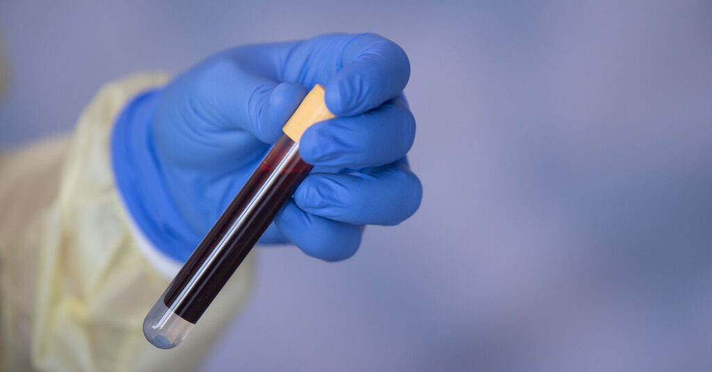 Grail’s Cancer Detection Test Fails in Major Study