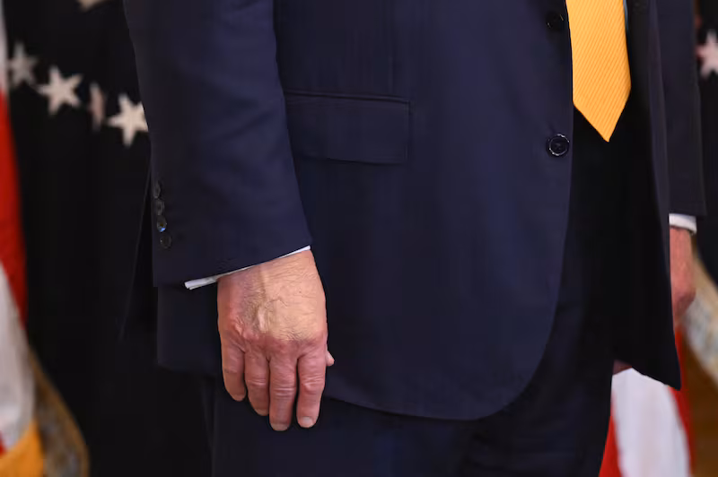 A view of President Donald Trump's right hand as he attends a Black History Month event in the East Room of the White House in Washington, DC, on February 18, 2026.