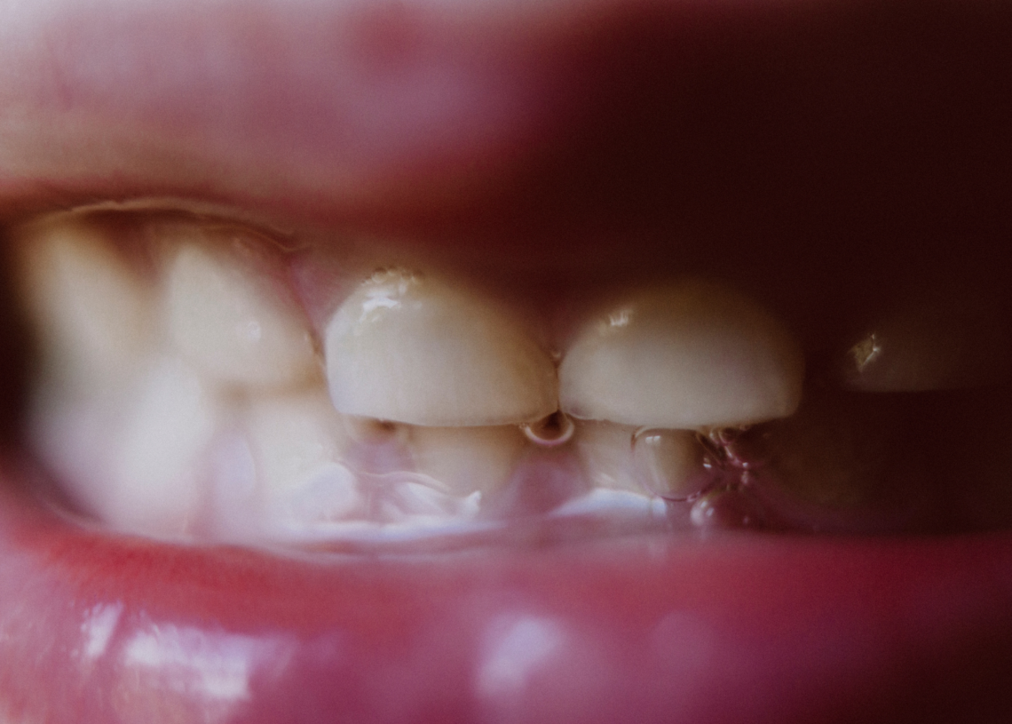 3 Signs You’re Grinding Your Teeth and Don’t Know, According to Experts