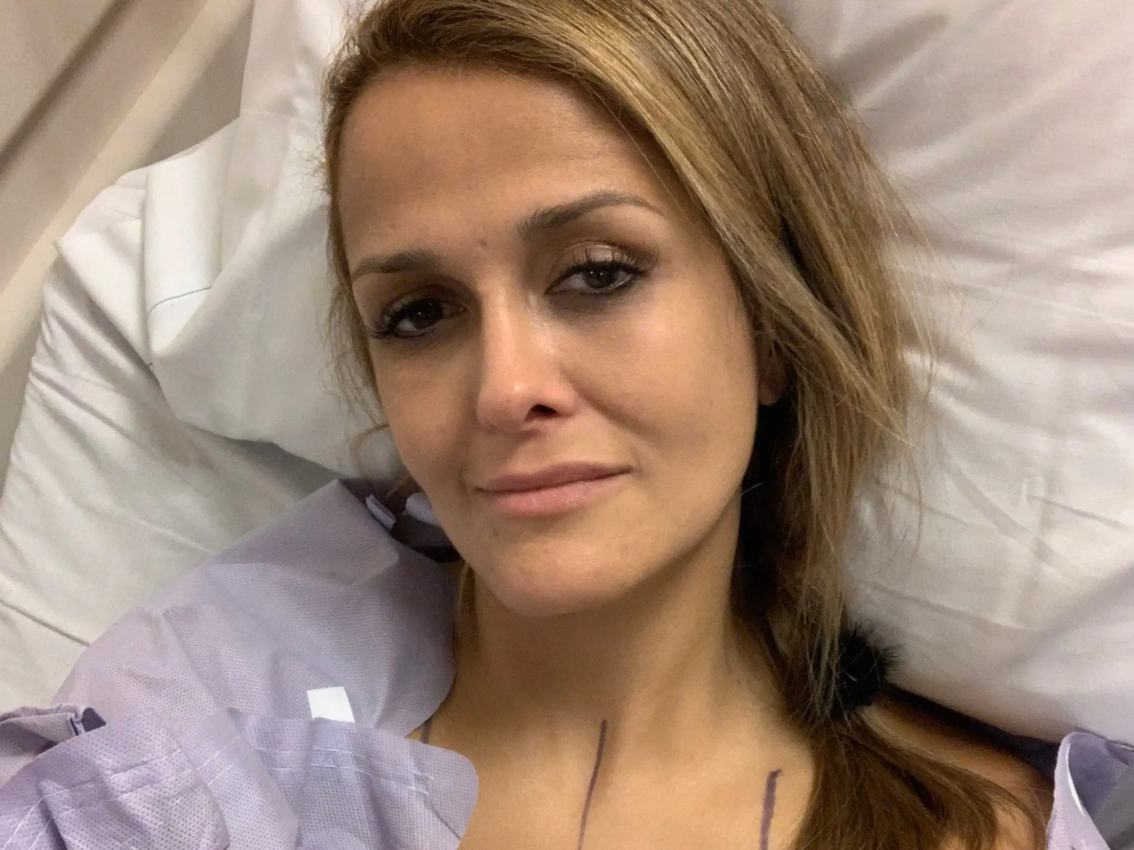 Dr. Thaïs Aliabadi before her double-mastectomy