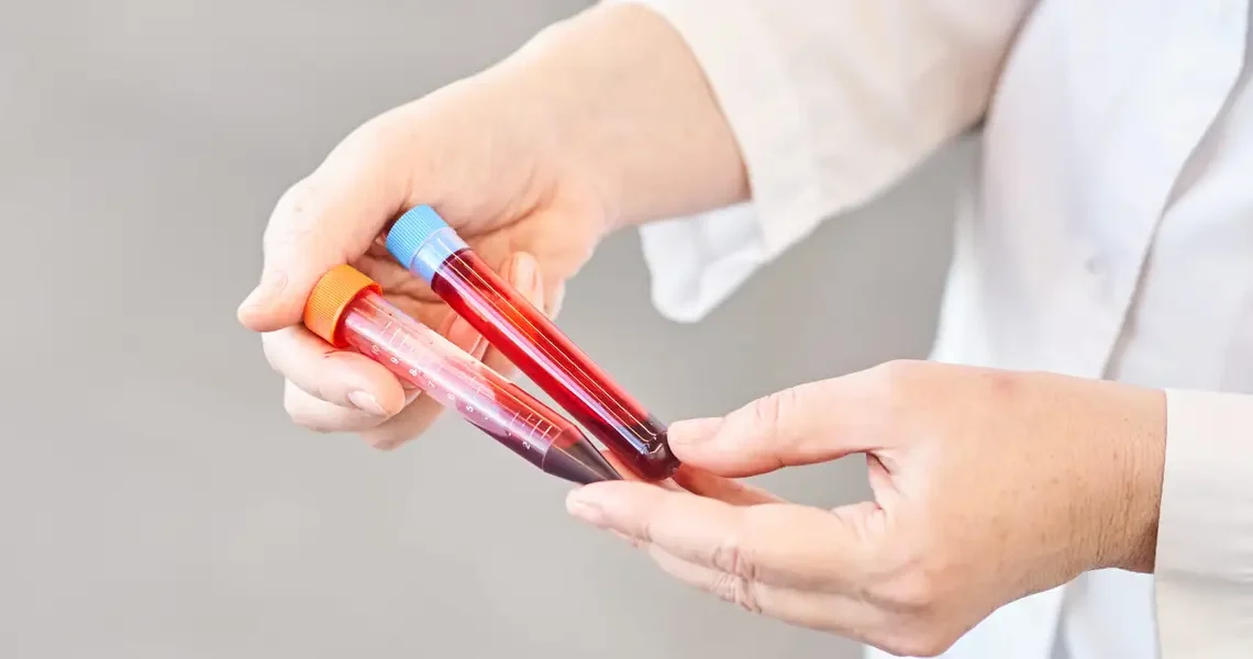 A $700 blood test promises to detect 50 different kinds of cancer. The results come with major caveats.