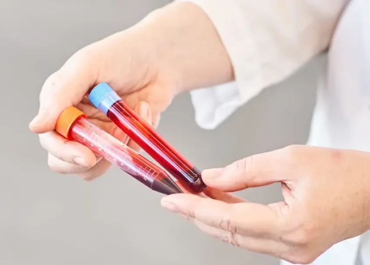 A $700 blood test promises to detect 50 different kinds of cancer. The results come with major caveats.