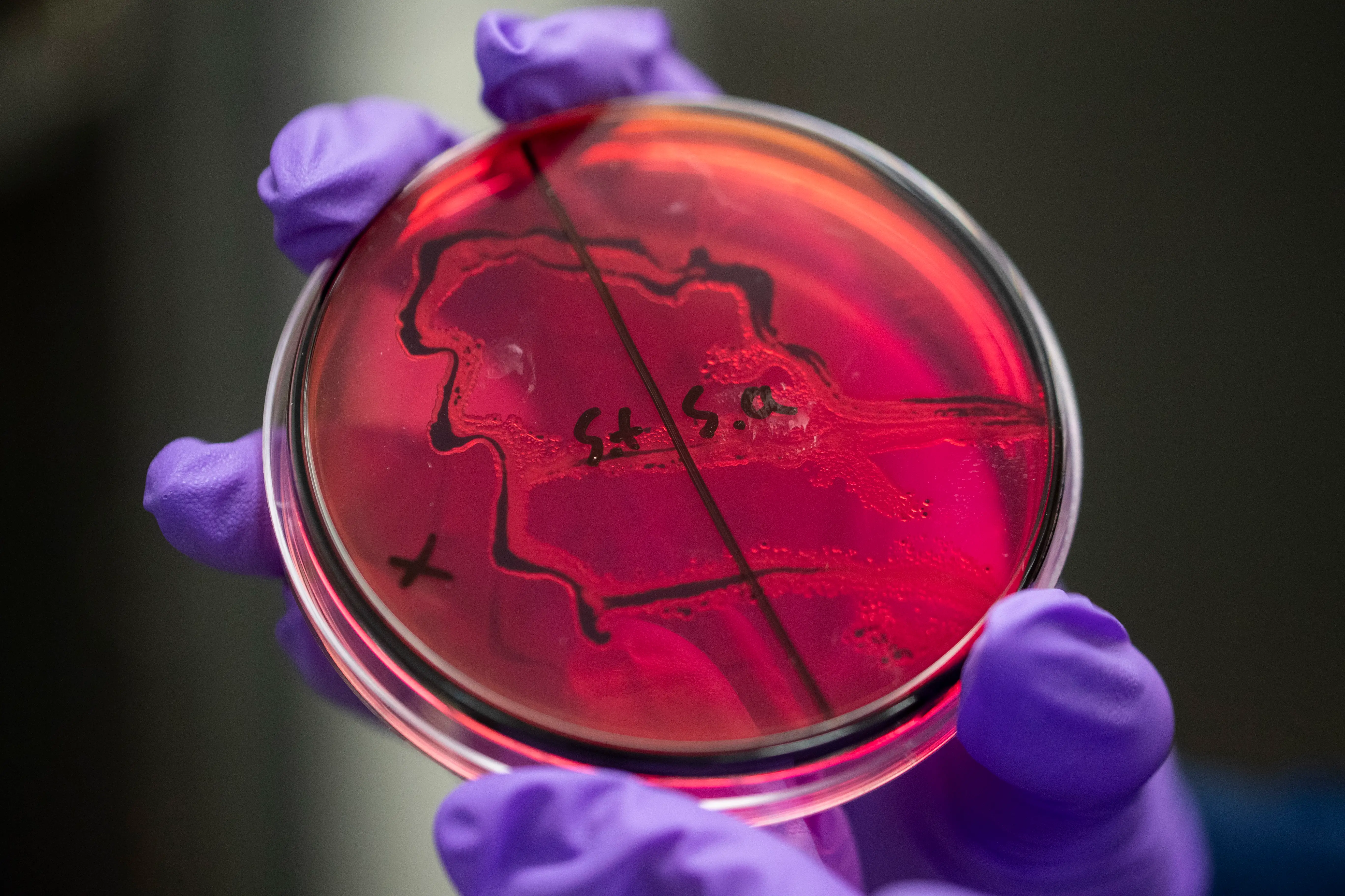 Autumn Mitchell holds up a testing tray with a culture on it inside the Thorne facility's micro lab, Friday, September 5, 2025, in Summerville.