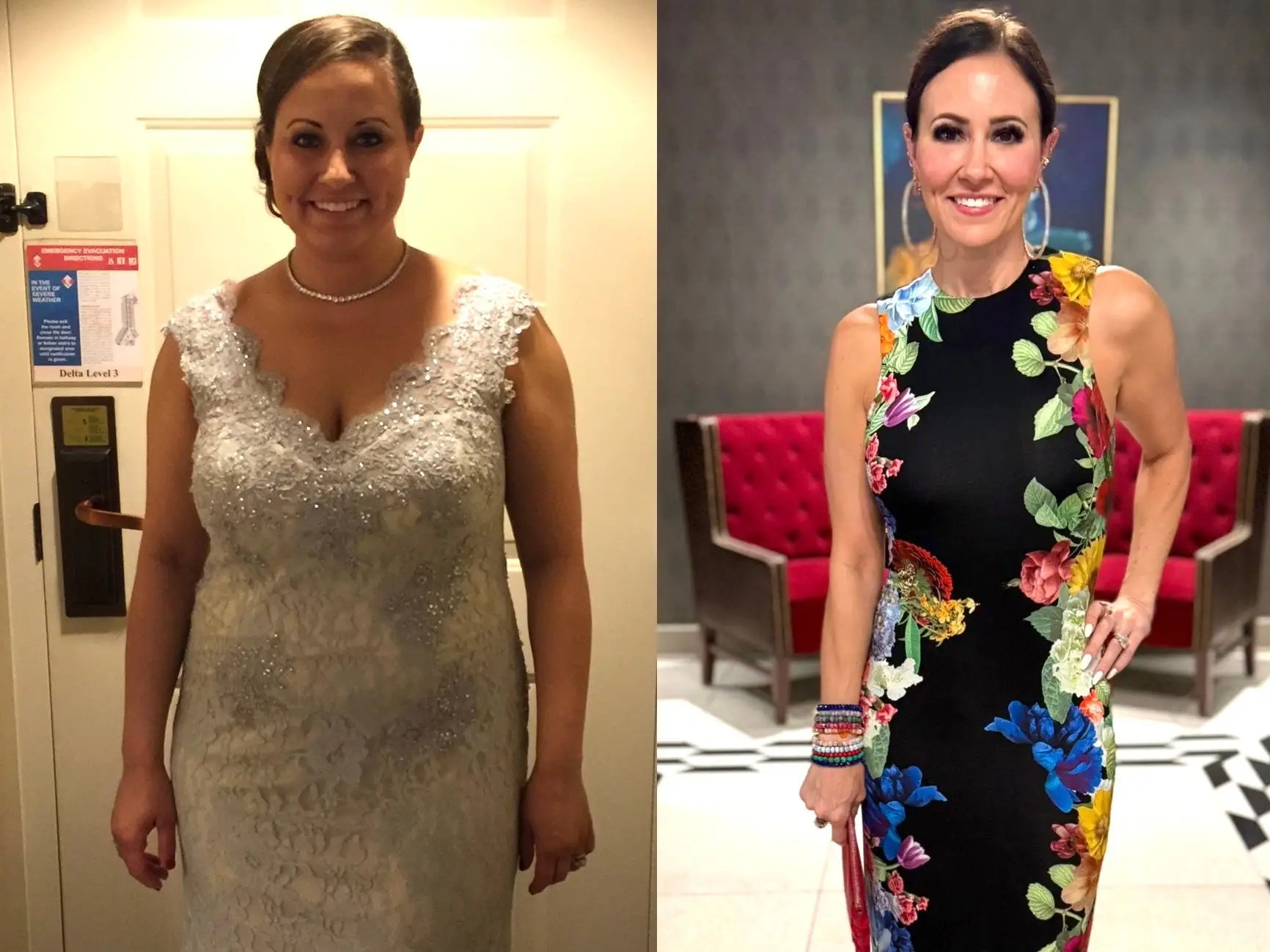 A before-and-after photograph of a woman who lost 100 pounds.