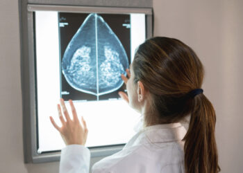 The case for more personalized breast cancer screening