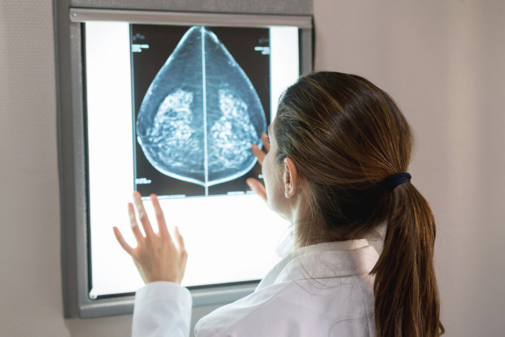 The case for more personalized breast cancer screening
