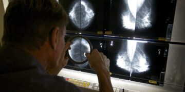 We may be doing breast cancer screening all wrong