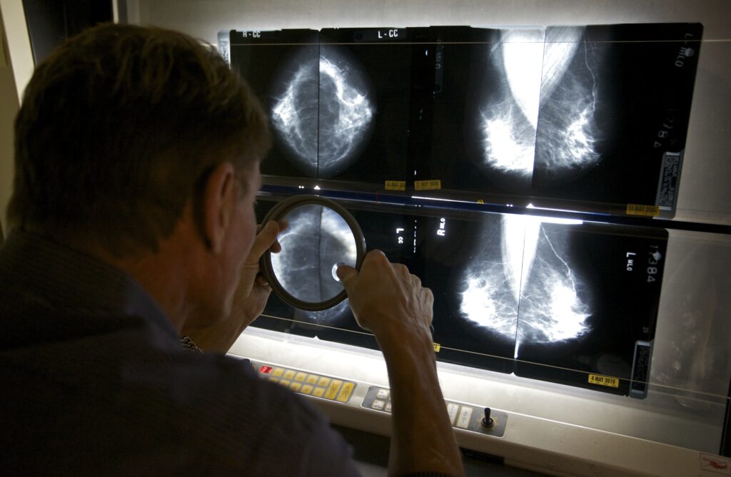 We may be doing breast cancer screening all wrong