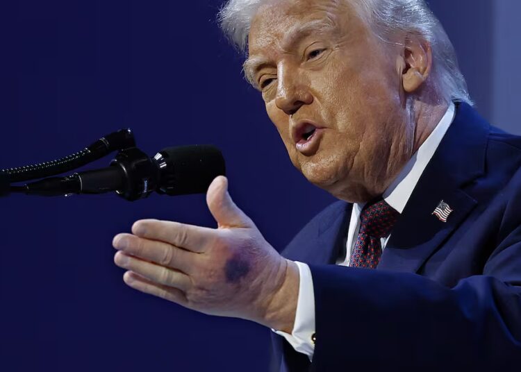 Top Doctor Calls BS on Trump’s Health Claims: ‘Makes No Sense’