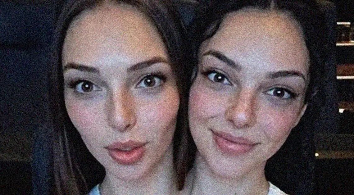 People Are Obsessed With These Conjoined Twins, But Are They Even Real?