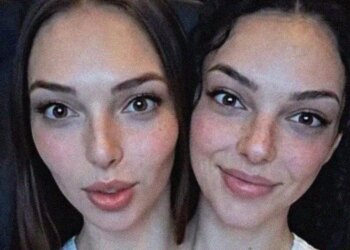 People Are Obsessed With These Conjoined Twins, But Are They Even Real?