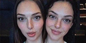 People Are Obsessed With These Conjoined Twins, But Are They Even Real?