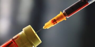 Blood tests show potential for predicting start of Alzheimer’s symptoms