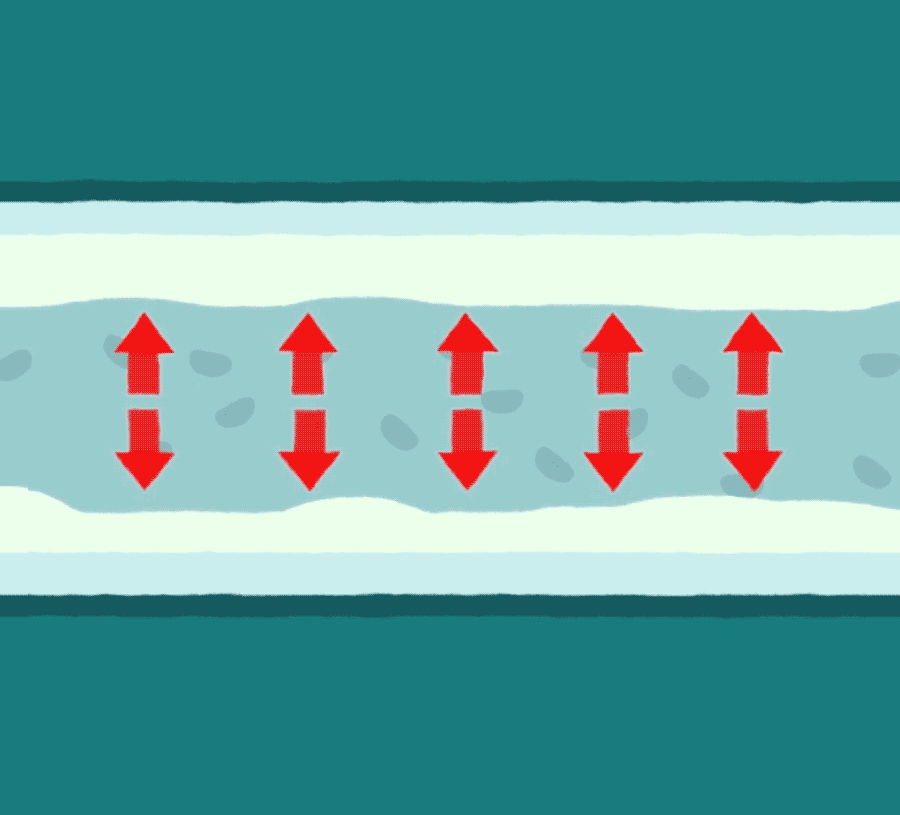 What high blood pressure does to your body