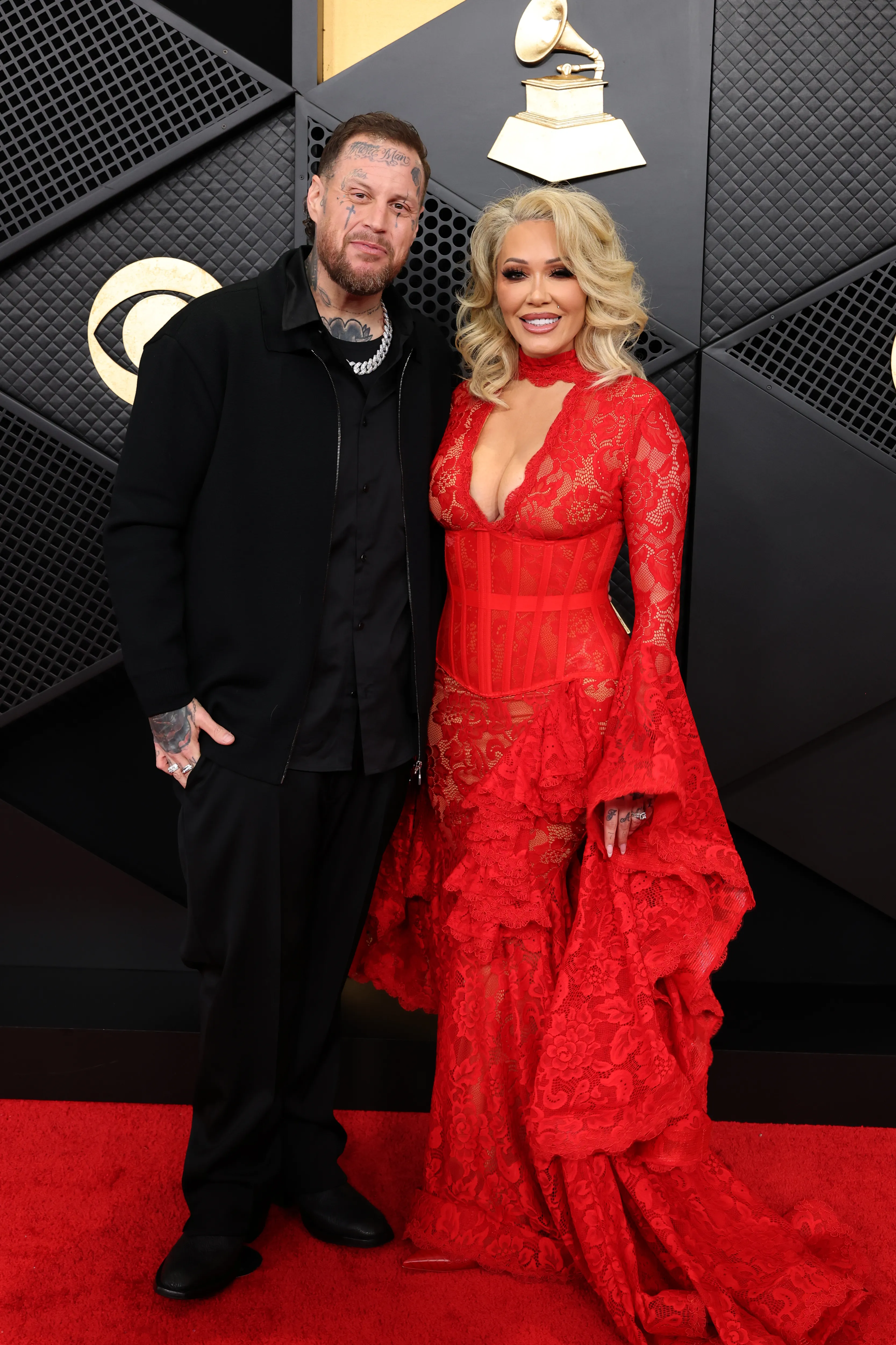 However, Jelly Roll opted against using GLP1's for weight loss.