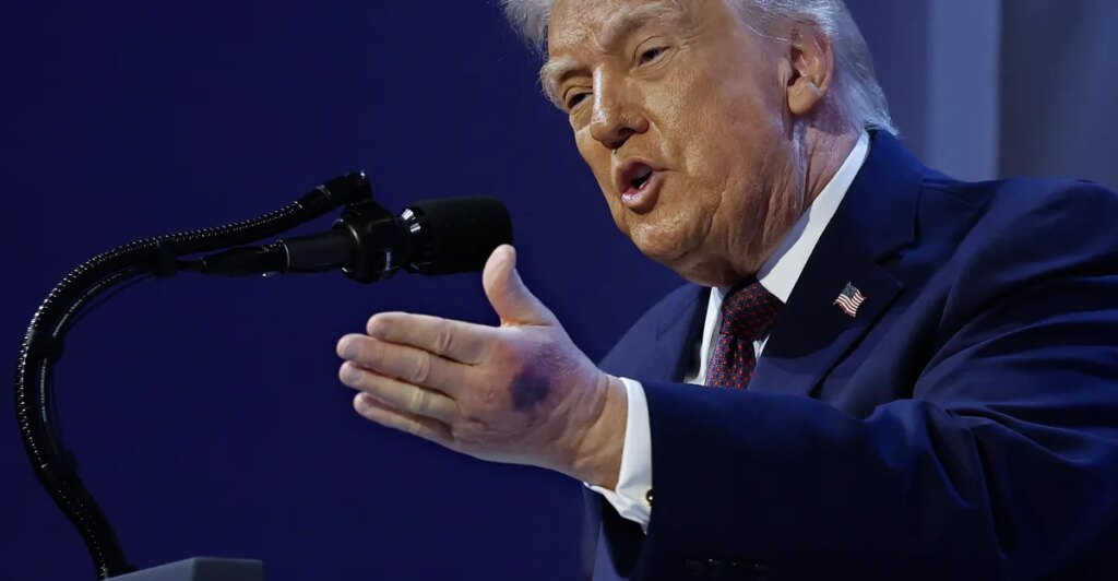 Just how healthy is Donald Trump, really?