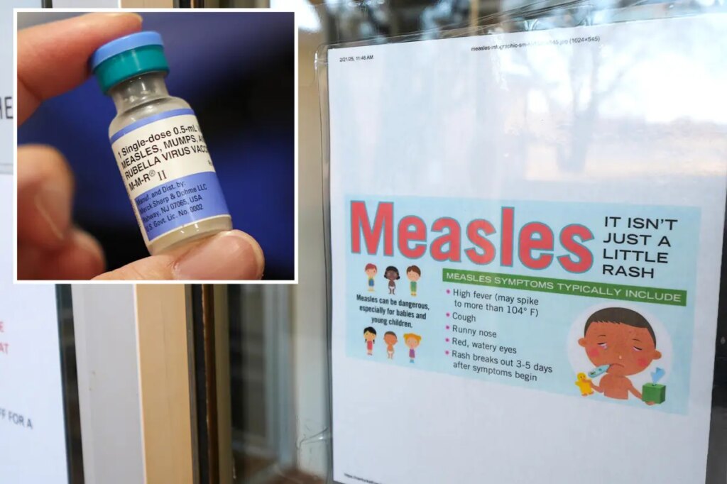 Measles case at Disneyland confirmed as officials issue exposure warning: ‘May be at risk’