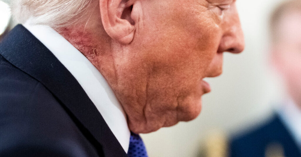 Latest Question on Trump’s Health: What Is That Neck Rash?