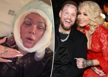 Jelly Roll’s 46-year-old wife, Bunnie Xo, unveils gruesome aftermath of facelift