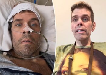 Perez Hilton reveals medical emergency that landed him in the hospital for 21 days: ‘My body kept falling apart’