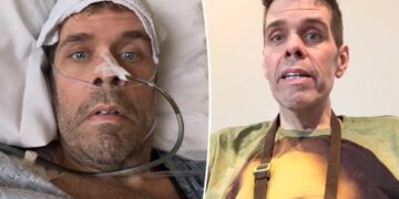 Perez Hilton reveals medical emergency that landed him in the hospital for 21 days: ‘My body kept falling apart’