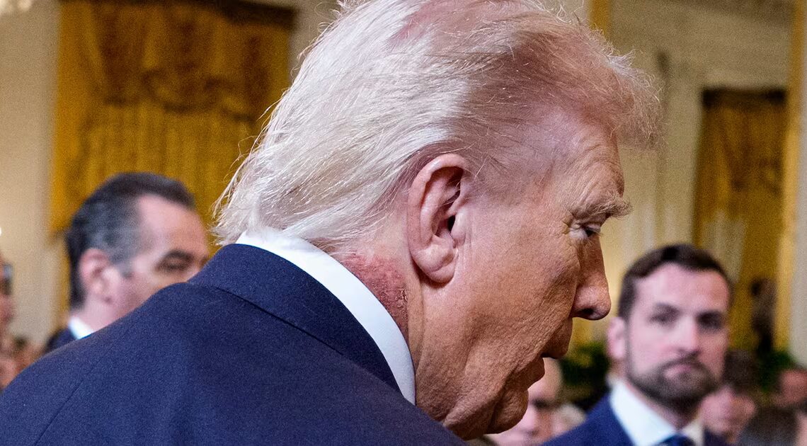 Doctors Sound Alarm on White House ‘Secrecy’ Over Trump’s Neck Rash