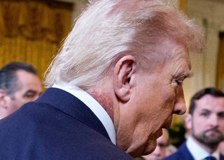 Doctors Sound Alarm on White House ‘Secrecy’ Over Trump’s Neck Rash