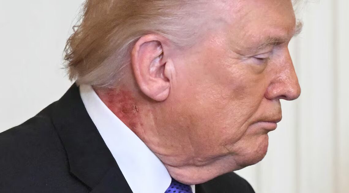 MAGA Melts Down Over 79-Year-Old Trump’s Bizarre New Ailment