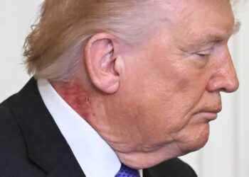 Doctor Says Trump’s Golf Habit May Be Reason for Mysterious Rash