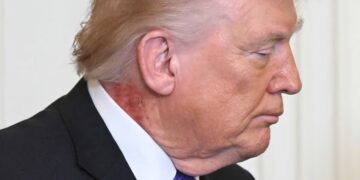 Doctor Says Trump’s Golf Habit May Be Reason for Mysterious Rash