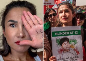 Iranian woman who lost her eye after being shot by the Revolutionary Guard slams Kamala Harris’ response to the bombing