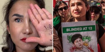 Iranian woman who lost her eye after being shot by the Revolutionary Guard slams Kamala Harris’ response to the bombing