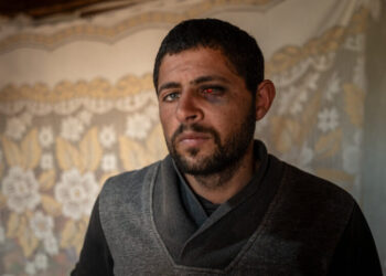 Palestinian Man Recounts Brutal Sexual Assault by Israeli Settlers
