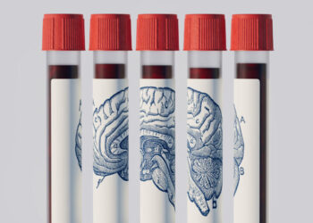 Could a Blood Test Predict if You’ll Get Alzheimer’s?