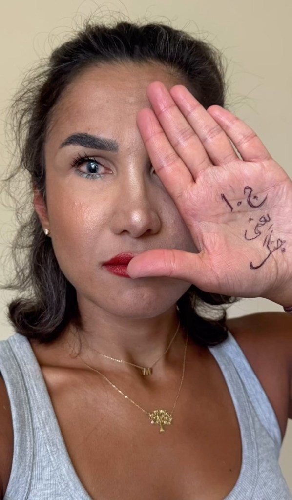 Mersedeh Shahinkar with her right eye covered by her hand, which has Arabic writing on it, showing the damage to her left eye.