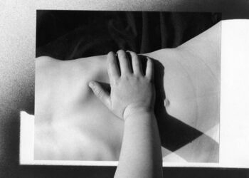 Vaccine Advances and the Prism of History