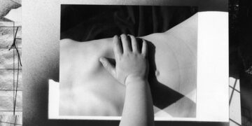 Vaccine Advances and the Prism of History