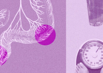 Nearly Half of Colorectal Cancers Now Occur in Younger Patients, Study Shows