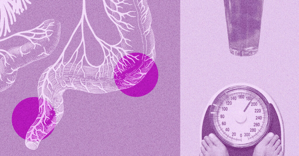 Nearly Half of Colorectal Cancers Now Occur in Younger Patients, Study Shows