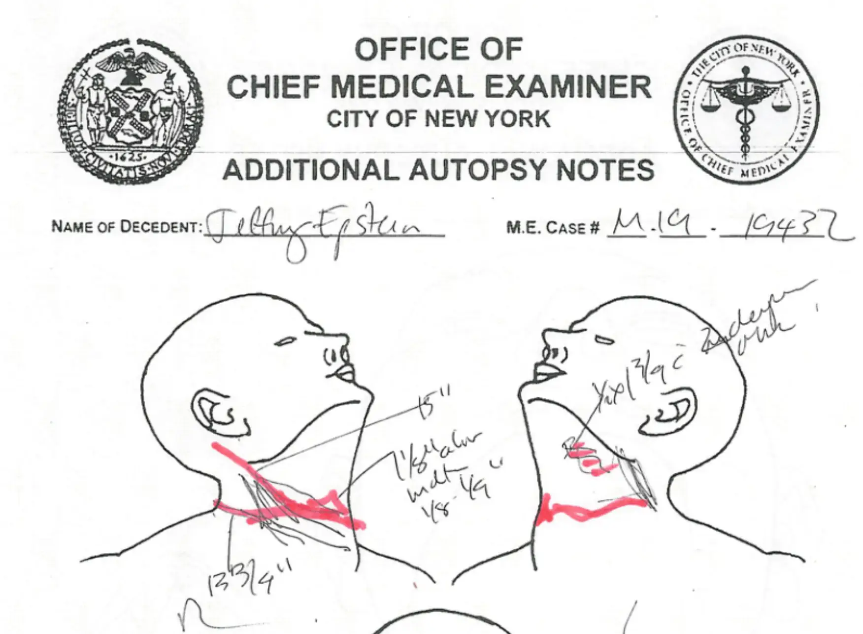 jeffrey epstein autopsy notes