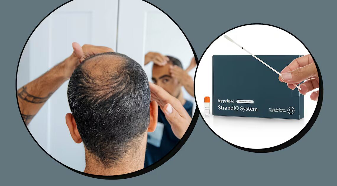 Scouted: I Took a DNA Test to Identify the Cause of My Hair Loss—Here’s What It Revealed