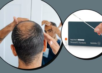 Scouted: I Took a DNA Test to Identify the Cause of My Hair Loss—Here’s What It Revealed