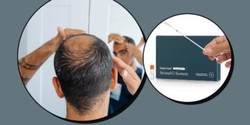 Scouted: I Took a DNA Test to Identify the Cause of My Hair Loss—Here’s What It Revealed