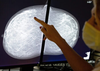 The surprising way breast cancer screenings could reveal heart disease