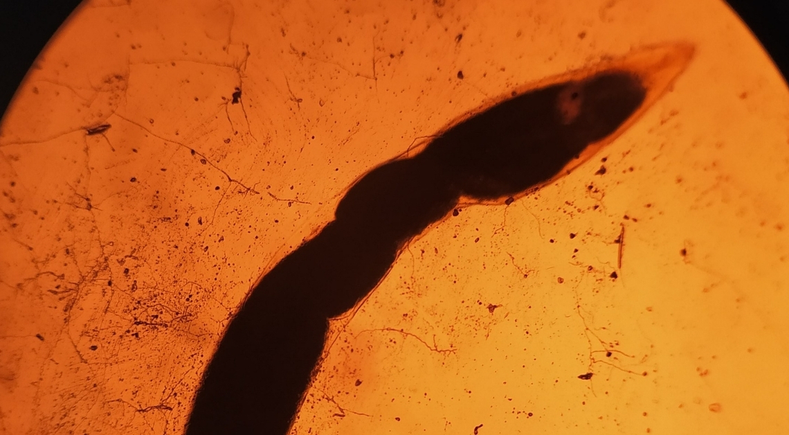 Brain-Invading Rat Lungworms Are Lurking in California