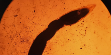 Brain-Invading Rat Lungworms Are Lurking in California